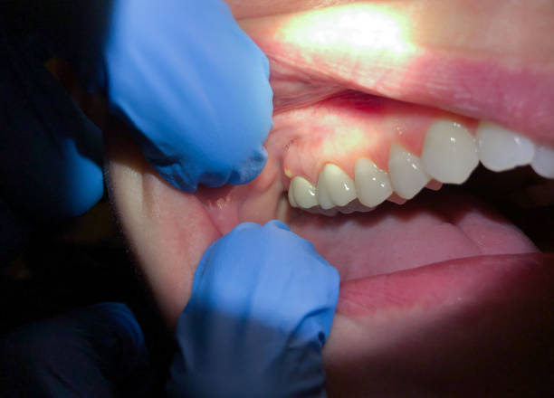 Best Broken Tooth Emergency  in Mount Sinai, NY